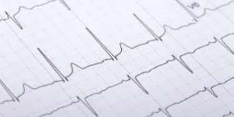 Das Motiv zeigt ein EKG