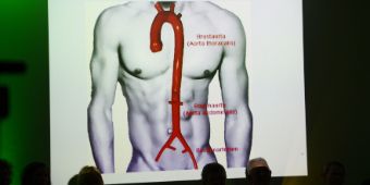Bild: Torsoansicht aus dem Slam von Prof. Hanke beim ersten Asklepios Doc Slam in Harburg